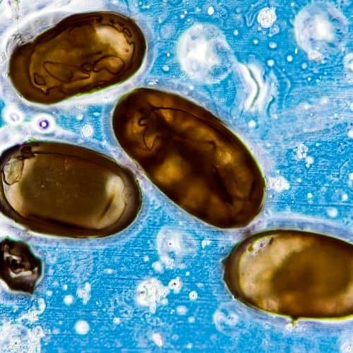 Where Do Fleas Live In The Yard? 5 Unlikely Places