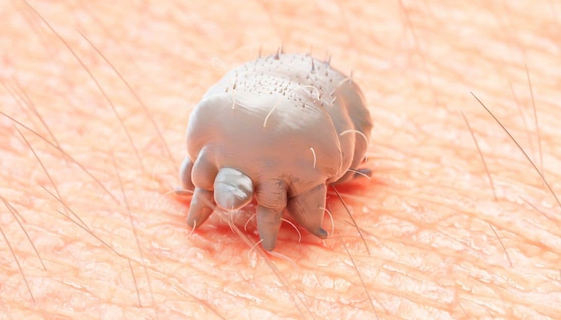 insects that burrow in human skin